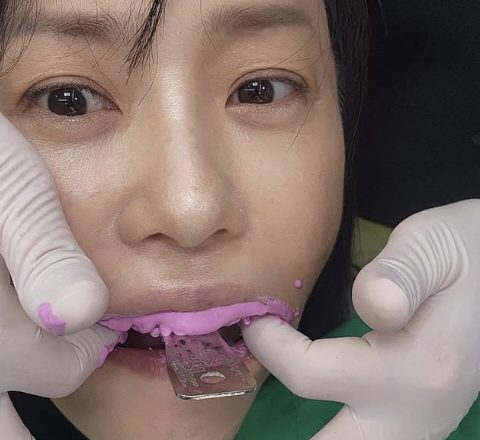 Ko Hyun-jung reveals a bare face selfie at the dentist’s office…